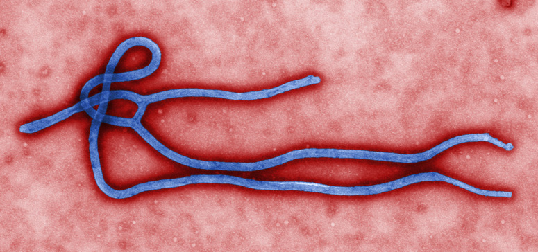 Ebola virus