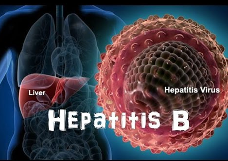 hepatitis