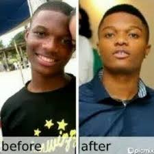 Wizkid