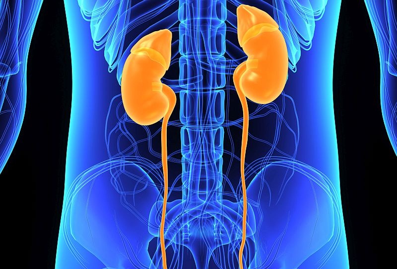 Kidney failure