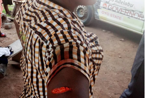 Oyo APC Chairman allegedly stabs woman leader